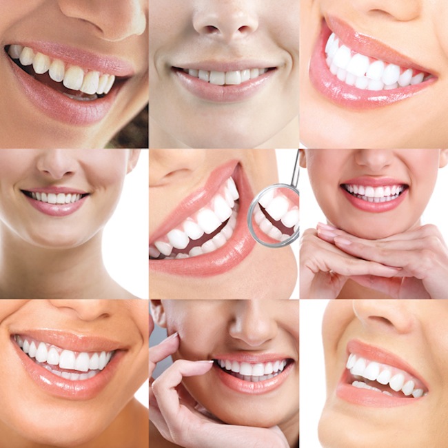 نگاهی به درمان‌های زیبایی در دندانپزشکی از دیدگاه جامعه‌‌شناسی سلامت