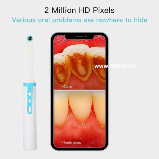 دوربین داخلی دهانی P10 Endoscope WiFi Dental Camera HD Intraoral بیسیم دندانپزشکی