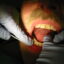 نقش بهداشت دهان در طول عمر ایمپلنت دندانی