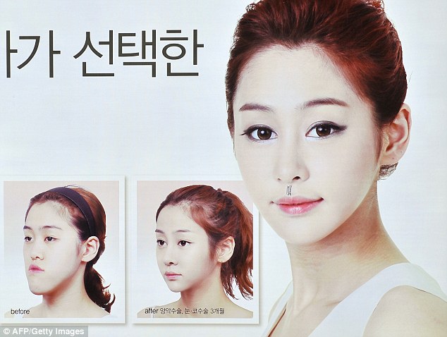 گزارشی از رواج جراحی زیبایی دو فک در کره جنوبی
