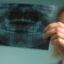 همه چیزهایی که می‌خواهید درباره عکس رادیوگرافی دهان و دندان بدانید