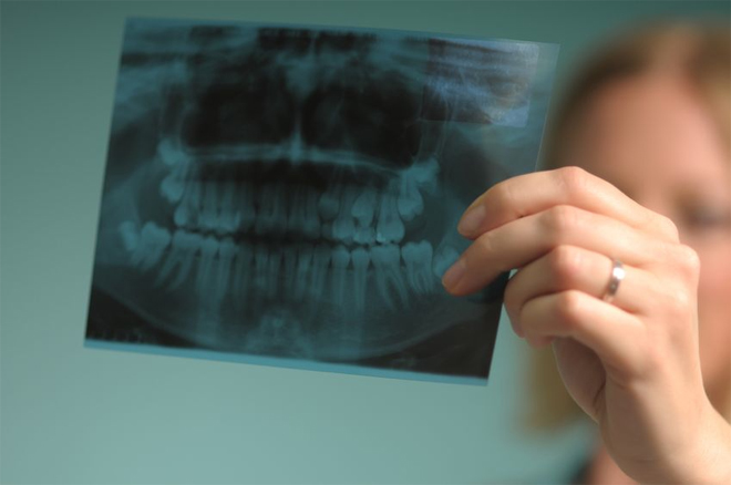 همه چیزهایی که می‌خواهید درباره عکس رادیوگرافی دهان و دندان بدانید