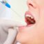 همه‌چیزهایی که می‌خواهید درباره بی‌حسی دندانپزشکی بدانید
