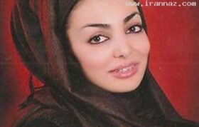 دختر اصفهانی رکورددار طولانی‌ترین دوره درمان ارتودنسی