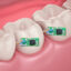 دندان‌های دیجیتال و ارسال اطلاعات نوشیدنی‌ها و مصرف دخانیات به دندانپزشک