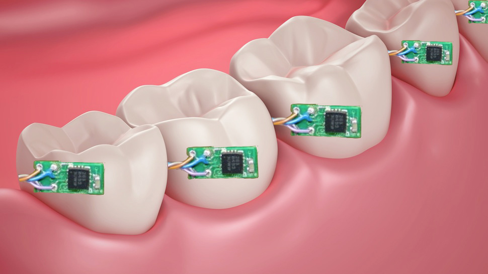 دندان‌های دیجیتال و ارسال اطلاعات نوشیدنی‌ها و مصرف دخانیات به دندانپزشک
