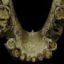 قدمت ۱.۸میلیون ساله خلال دندان!
