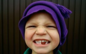 عوارض زود از دست رفتن دندان‌های شیری