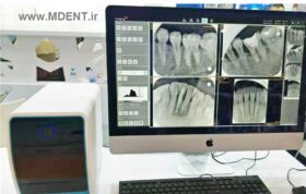 فسفرپلیت Dental Plate Scanner TYRIS TR-120 تایریس