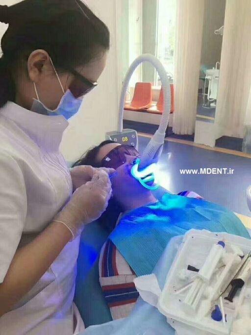 بلیچینگ Teeth Whitening Bleaching System LED Light MD666 ملانی