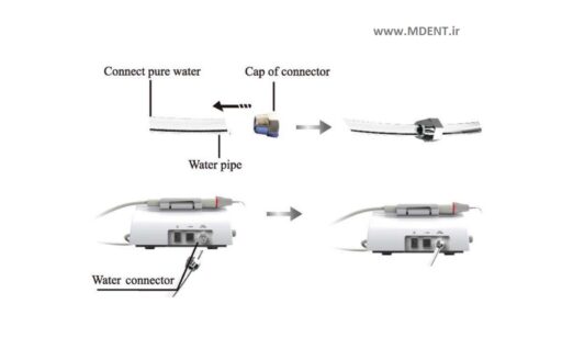 جرمگیر وودپیکر Woodpecker Dental Ultrasonic Piezo Scaler UDS-P کویترون پیزون