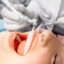 شوک یافته‌های محققین بریتانیایی به جامعه‌ی دندانپزشکی: پولیش و جرم‌گیری، نقشی در پیشگیری از بیماری پریودنتال ندارد