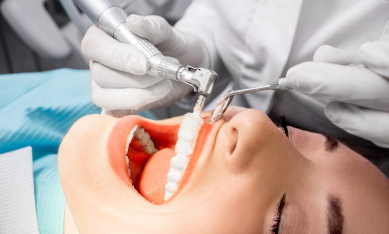 شوک یافته‌های محققین بریتانیایی به جامعه‌ی دندانپزشکی: پولیش و جرم‌گیری، نقشی در پیشگیری از بیماری پریودنتال ندارد
