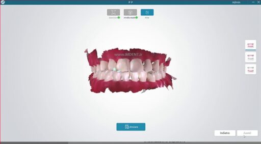 دوربین داخل دهانی newlife نیولایف مدل DIGISMILE